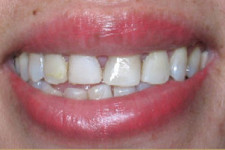 Teeth Image2