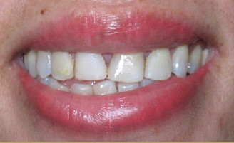 Teeth Image2